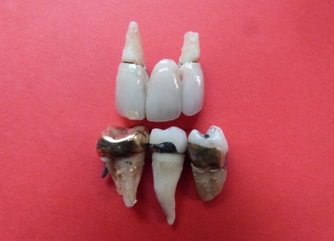 Campagne De Mond Niet Vergeten!