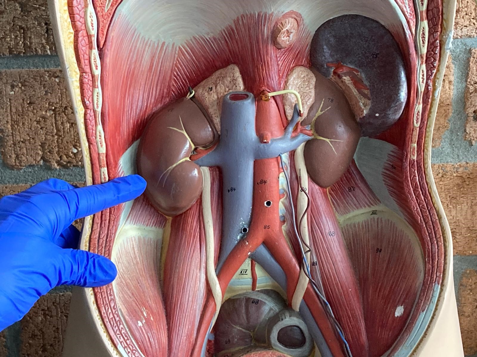 Bijeenkomst Nier in het Vizier